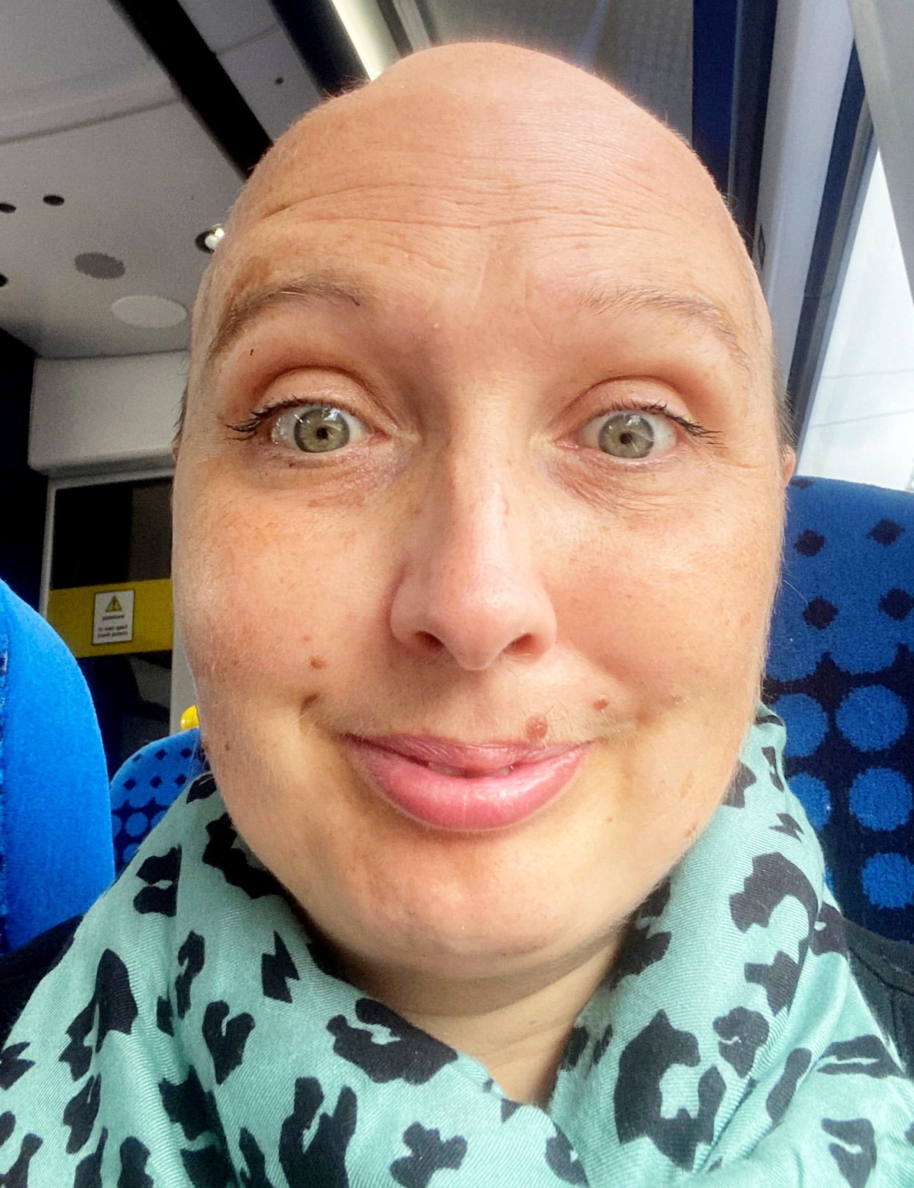 Lizzie Pitt bojuje naďalej a hľadá nové možnosti liečby.