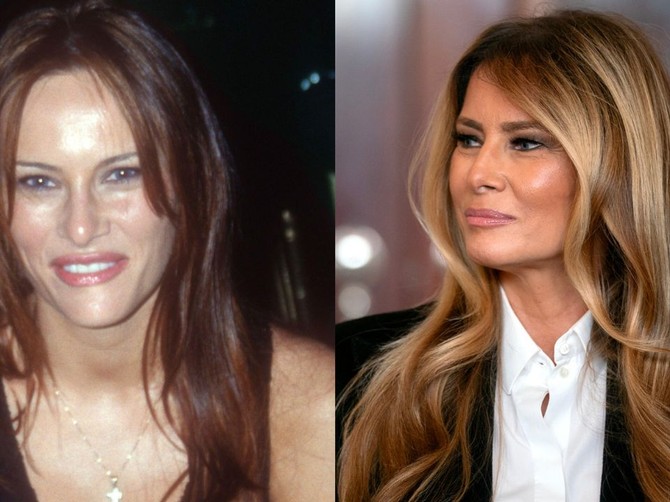 Melanija Tramp nekad i sad