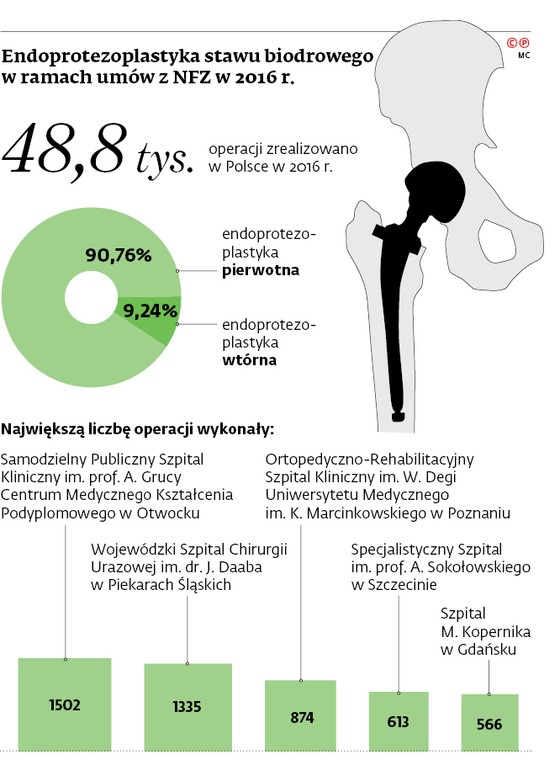 Endoprotezoplastyka  stawu biodrowego w ramach umów z NFZ w 2016 r.