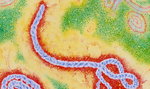 Przetestują na ludziach szczepionkę na Ebolę
