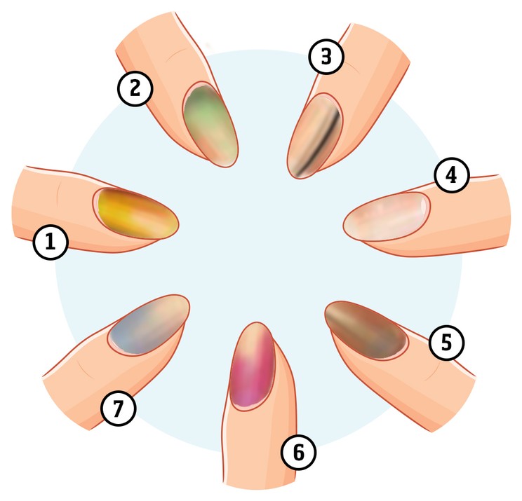 Nuestras uñas pueden cambiar de color debido a diversas enfermedades / Ilustración: Serra Tamas