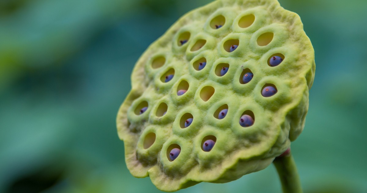 Dr. Pimple Popper Removes a Huge Blackhead From a Patient's Back in Her