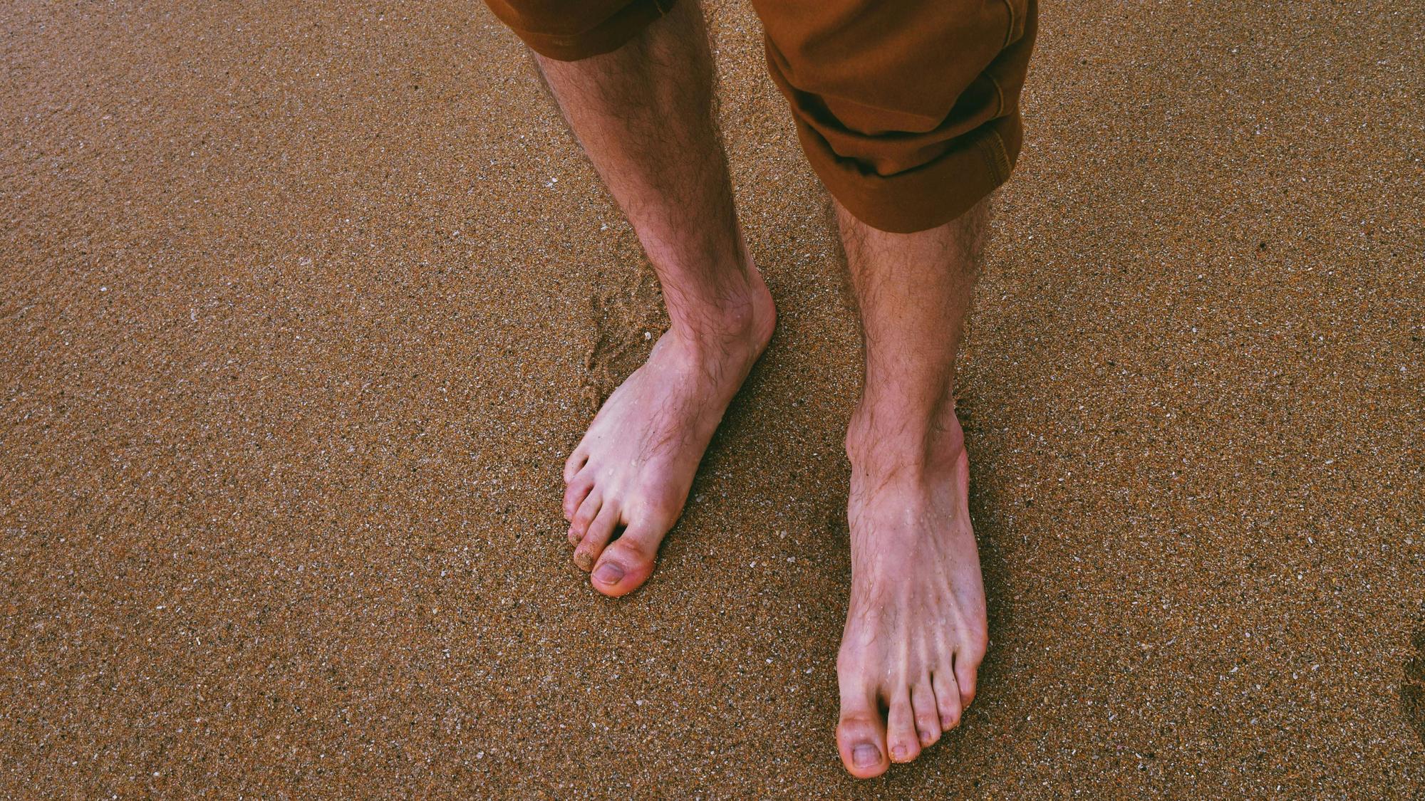 Pichanie v nohách môže signalizovať kŕčové žily aj bez toho, aby ste ich videli. 