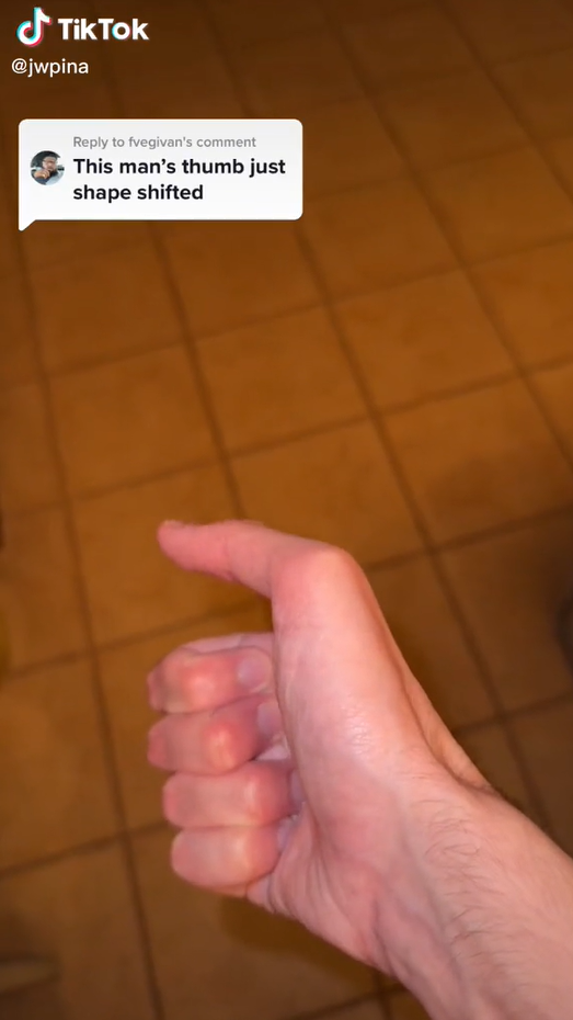 Jeho zvláštna anomália mu získala milióny zhliadnutí na sociálnej sieti TikTok. 