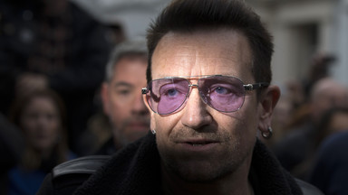 Bono po wypadku - złamana ręka, palce i pęknięty oczodół