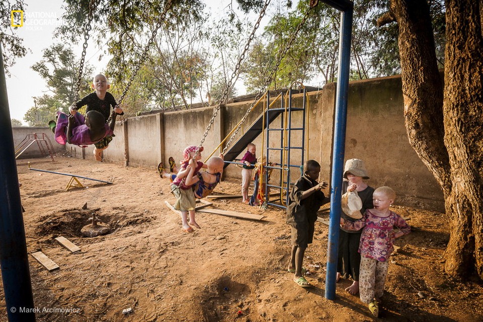 Ludzie duchy - jak bielactwo determinuje życie w Tanzanii