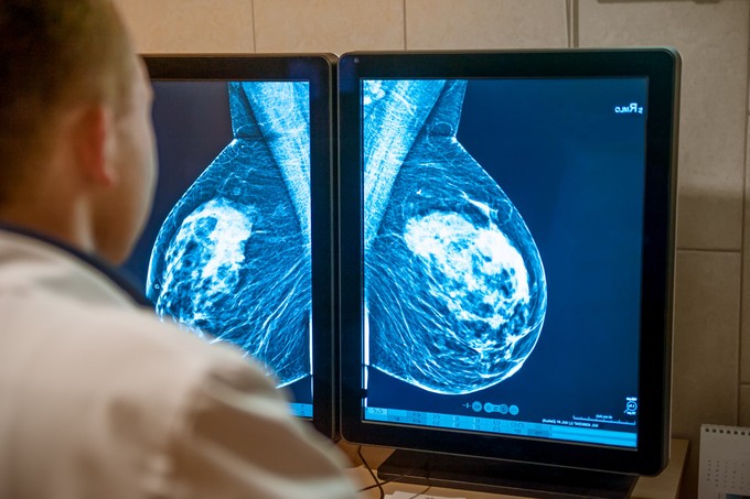 A mellrák korai felismerésére fejlesztenek új diagnosztikai eszközt szegedi kutatók