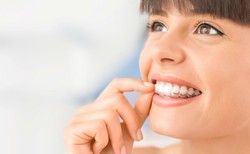 Ortodoncja może być estetyczna