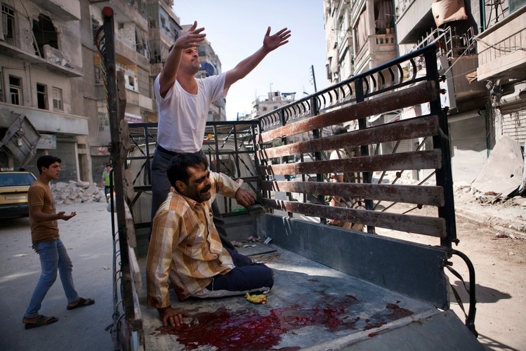 Transport rannego do szpitala w Aleppo