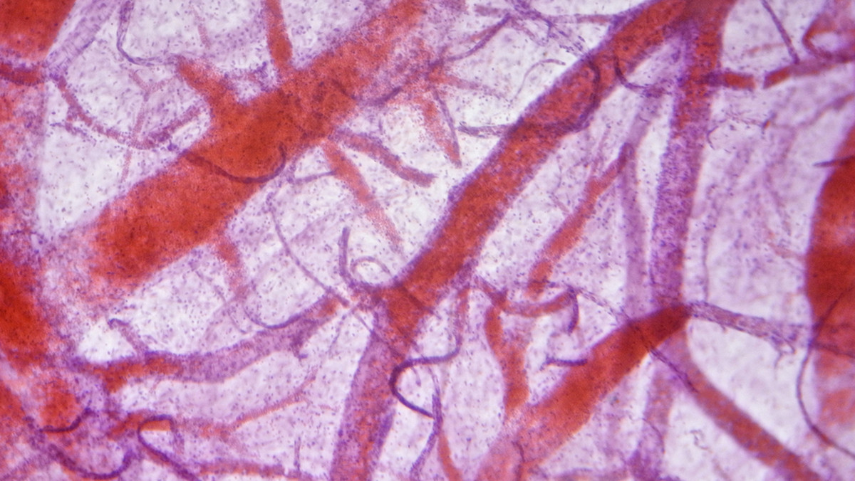 <strong>Tabletki Cyclonamine</strong> to lek dostępny na receptę, którego <strong>cena</strong> to ok. 20 zł. <strong>Tabletki Cyclonamine</strong> stosowane są w przypadku nadmiernych krwawień (np. po operacjach), w terapii problemów krążenia w oku oraz w leczeniu zaburzeń krwotocznych małych naczyń krwionośnych.