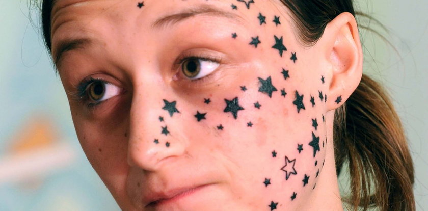 Wydała krocie na usunięcie gwiazdek, wytatuowanych na twarzy. Jak dzisiaj wygląda?