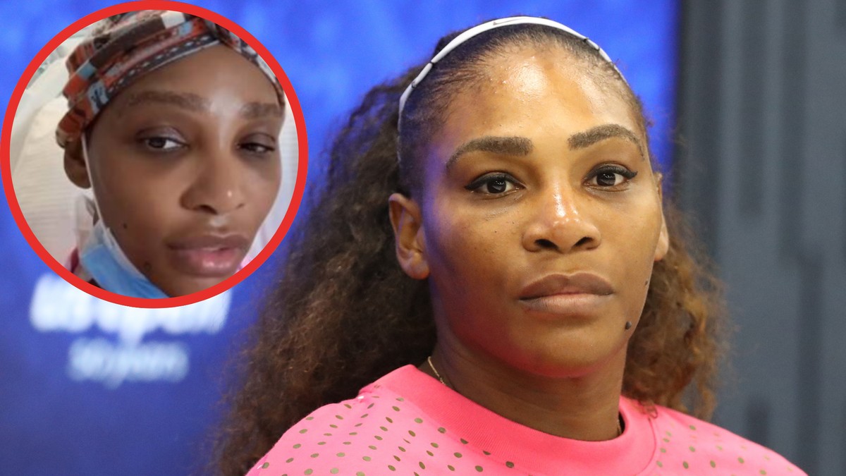 Serena Williams przeszła operację wycięcia guza