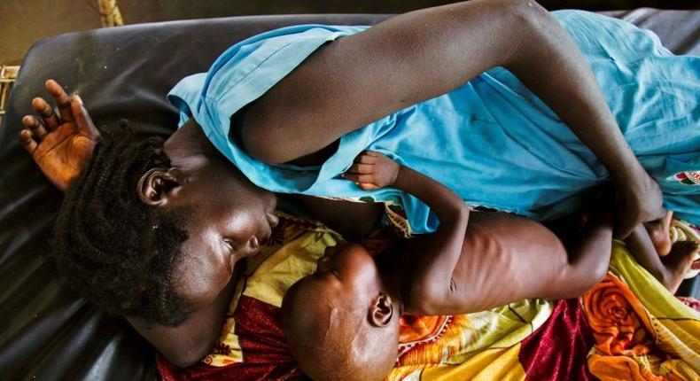 A mother breastfeeds her child who suffers acute malnutrition, at the clinic run by Doctors Without Borders (MSF) in Aweil, northern Bahr al-Ghazal, South Sudan