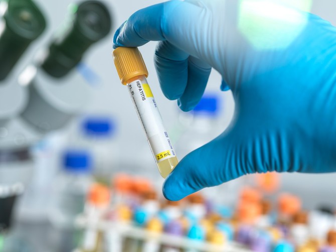Najviše dokaza da je uzročnik oboljenja jetre kod dece adenovirus (tip 41 F) 