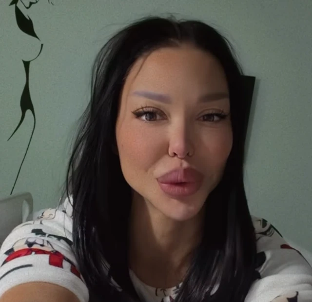 IZVADILA SILIKONE IZ ZADNJICE! Maja Marinković se oglasila: "Operacija je prošla uspešno"