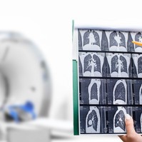Nőnap alkalmából tüdőrákszűrő napot hirdet az Országos Korányi Pulmonológiai Intézet