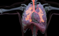 Zapalenie oskrzelików wywołane RSV szczególnie niebezpieczne u...