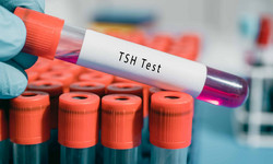 Co oznacza wysokie TSH? Diagnosta wyjaśnia