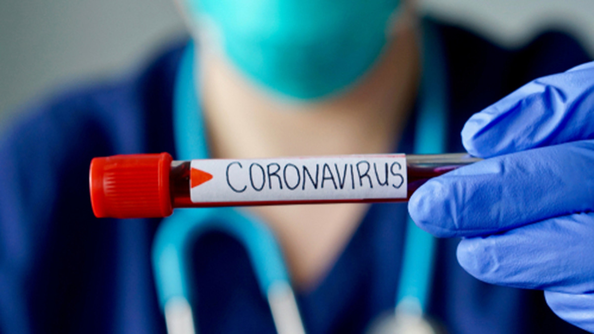 Koronawirus w Polsce. Jak pracodawcy mogą ograniczać ryzyko zakażeń?