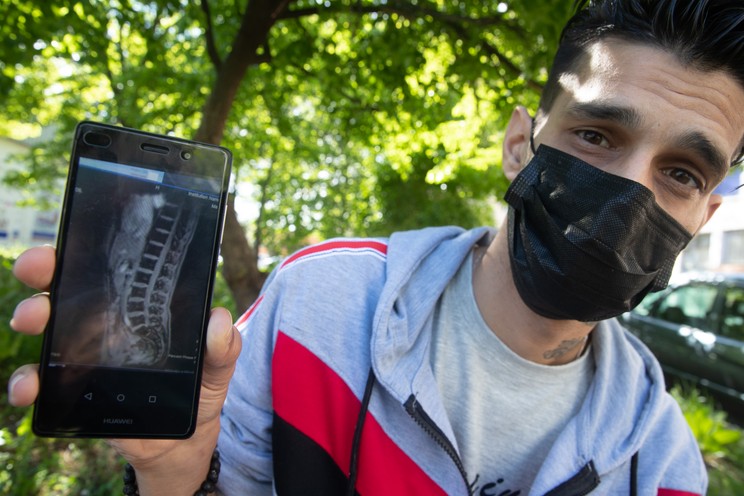 Csaba hiába vár a gerincstabilizáló műtétre, egyelőre még nem került sorra  /Fotó: Zsolnai Péter