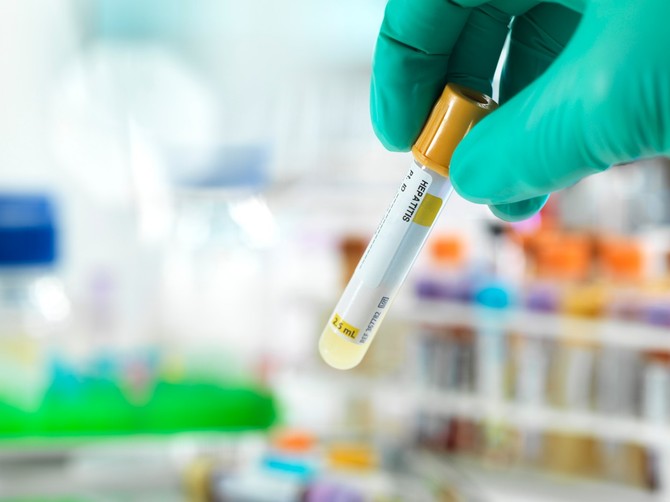 Najviše dokaza da je uzročnik oboljenja jetre kod dece adenovirus (tip 41 F)