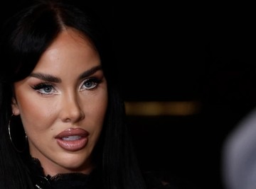 ROĐENA MAJKA DA JE NE PREPOZNA: Aleksandra Subotić je ovako izgledala PRE OPERACIJA - Prvu intervenciju imala kao maloletna, a evo šta je sve menjala na sebi