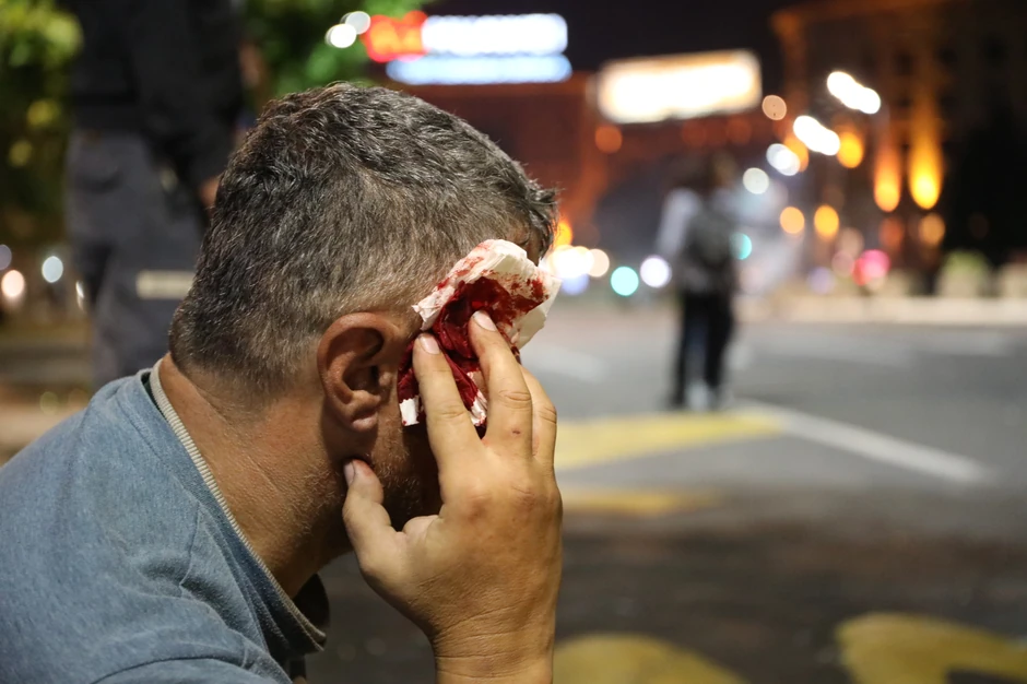 Jedan od građana zadobio je udarce po glavi