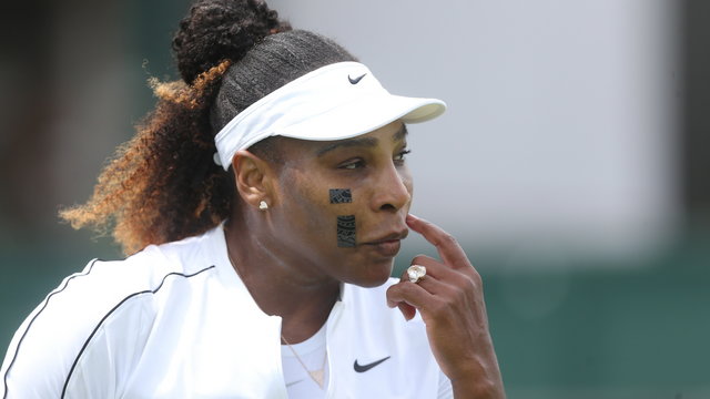 Serena Williams furcsa, fekete tapaszokkal az arcán teniszezik, kiderült miért
