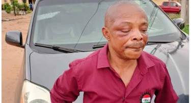 I was beaten – NLC President Joe Ajaero recounts brutal ordeal in police custody