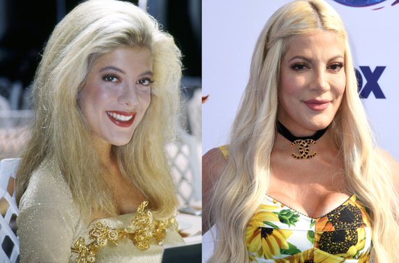 Tori Spelling w 1992 r. i obecnie