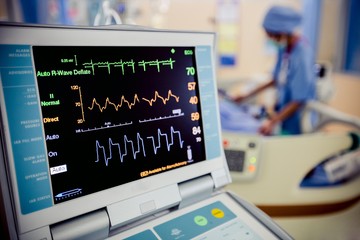Terheléses vagy nyugalmi EKG: mikor, melyik vizsgálatra van szükség?
