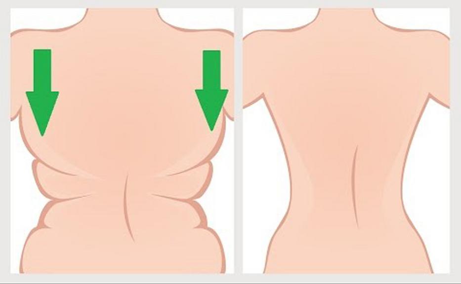 Hogyan kell eltávolítani a zsírt alatt a hónalj körül, és a közelükben