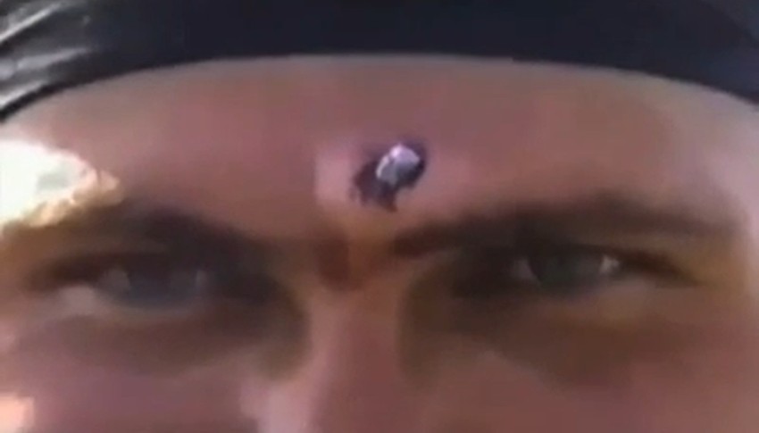 Čvrsto zaglavljen metak u čelu "Terminatora iz Rusije"