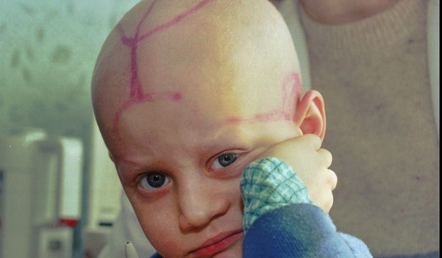 Alek Žloba sedi na dečjem odeljenju za rak sa oznakama koje su mu lekari napravili na glavi nakon hemoterapije u Gomelu, Belorusija, 19. marta 1996. godine, skoro 10 godina nakon eksplozije i požara u nuklearnoj elektrani Černobilj