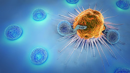 Hipertermia pobudza układ odpornościowy do walki z nowotworem
