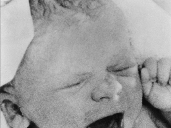 Kako danas izgleda prva bebe rođena uz pomoć vantelesne oplodnje