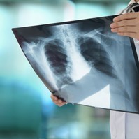 Tüdőgyulladás: változatos és néha furcsa tünetekkel is járhat