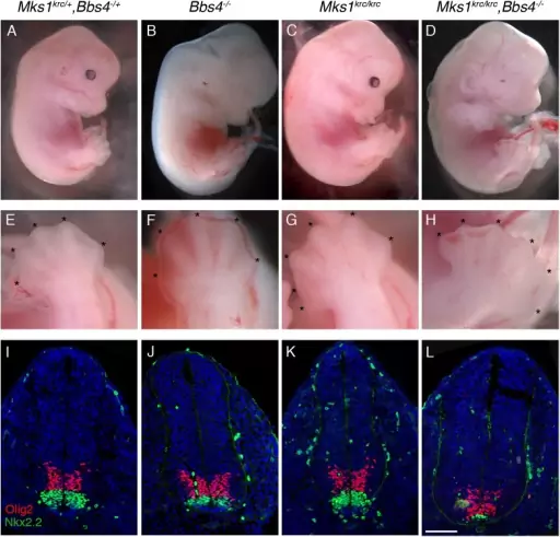Embriony z mutacją powodującą zespół Meckela-Grubera, jedną z chorób, które były przesłanką do terminacji ciąży