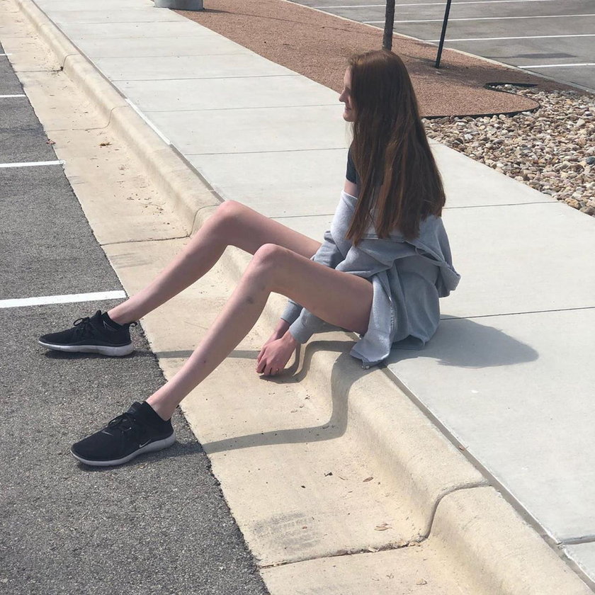Ta dziewczyna ma najdłuższe nogi na świecie. I ciągle rośnie