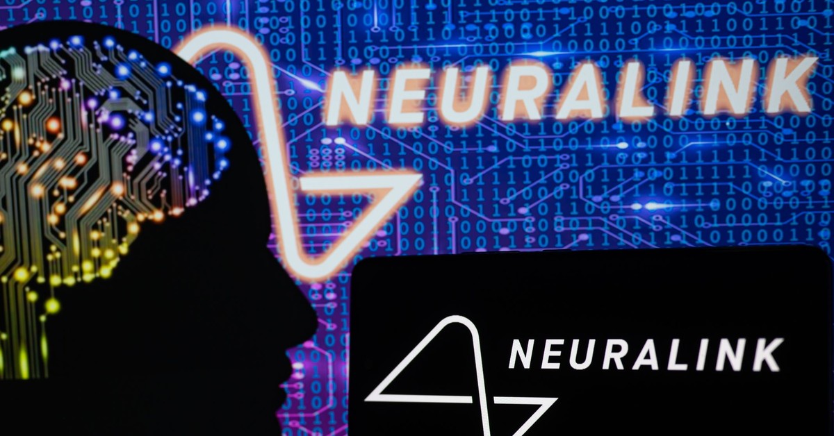 650 milionów dolarów dla Neuralink. Przełomowy implant Elona Muska wchodzi w fazę badań klinicznych