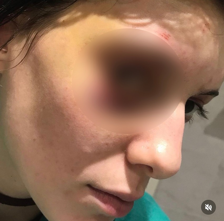 Fotografije na kojima se vide povrede 