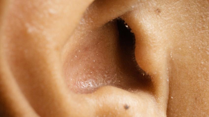 fül, kánikula hőség erős fokozott izzadás oka hormonzavar tünete