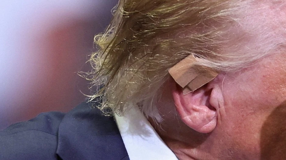 Zmesto velikog belog zavoja, preko uva je sada bio flaster | Foto: REUTERS/Tom Brenner