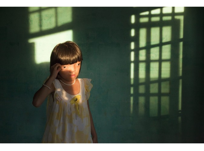 Druga nagroda w kategorii 'problemy współczesne - zdjęcie pojedyncze'. Otrzymał ją Ed Kashi z VII Photo Agency za portret 9-letniej Nguyen Thi Ly, ofiary Agent Orange - toksycznego preparatu, stosowanego na masową skalę podczas wojny w Wietnamie