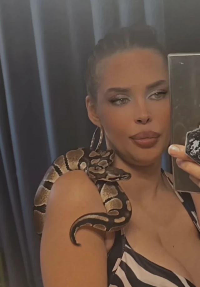 Ovako danas izgleda STARLETA koja je PREŽIVELA HOROR: Nakon dve operacije oka i REKONSTRUKCIJE LICA pozirala u ogledalu sa DIVLJOM životinjom (FOTO)