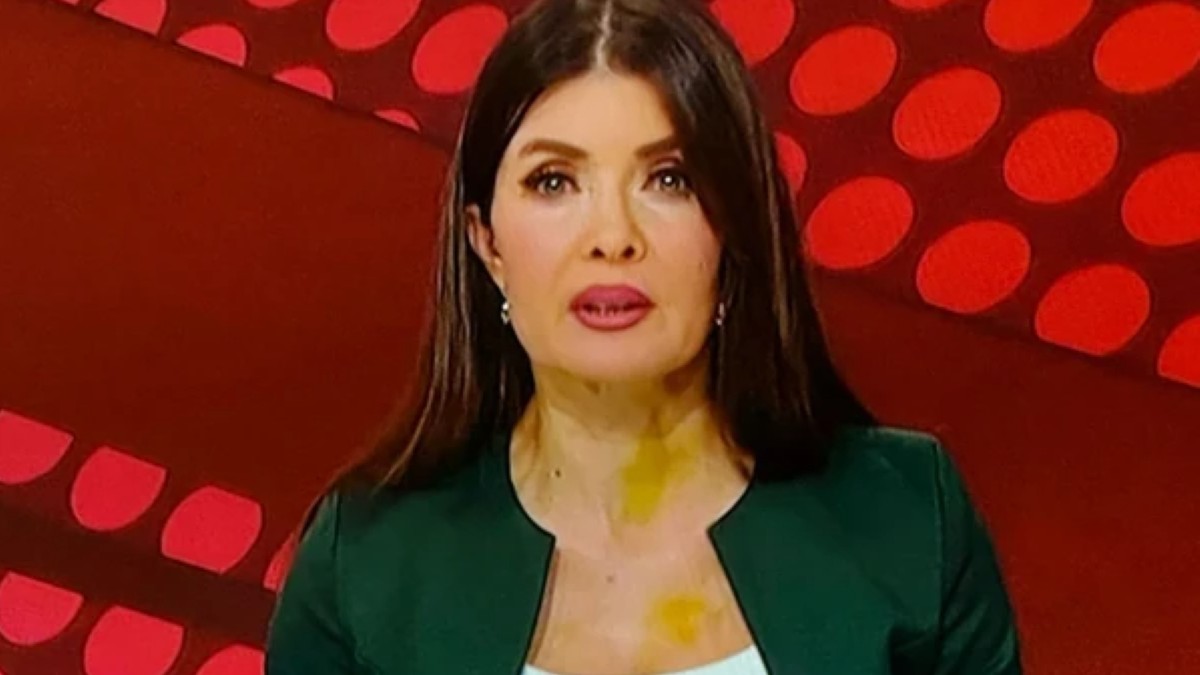 Gordana Stijačić sa mrljama na vratu