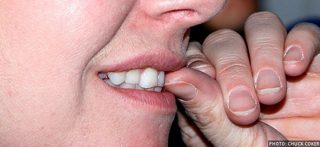 64313_nail_biting_teeth