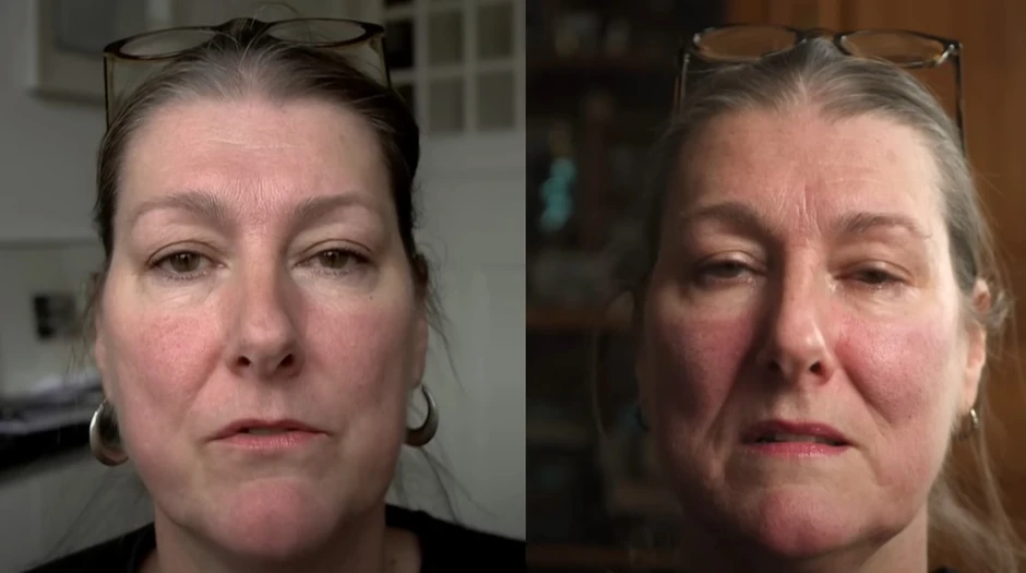 Razlika od 10 godina