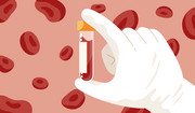 Co może być przyczyną podwyższonego kwasu moczowego we krwi?
