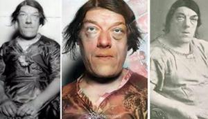 Mary Ann Bevan won an 'ugliest woman in the world' competition [Fact Issues]